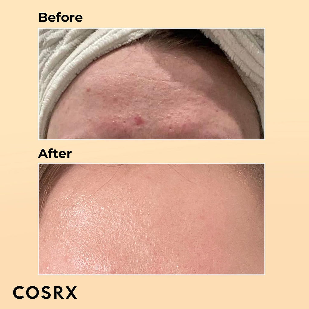 COSRX Snail Mucin 96% Power Repairing Essence 100ml, Hydrating Serum with Snail Secretion Filtrate for Dull & Damaged Skin