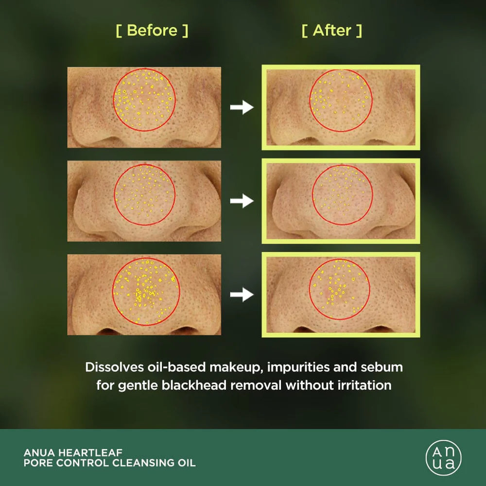 Anua HEARTLEAF PORE CONTROL CLEANSING OIL, 200ml