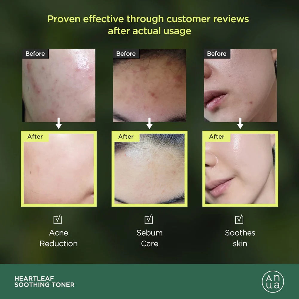 Anua HEARTLEAF 77% SOOTHING TONER, 250ml